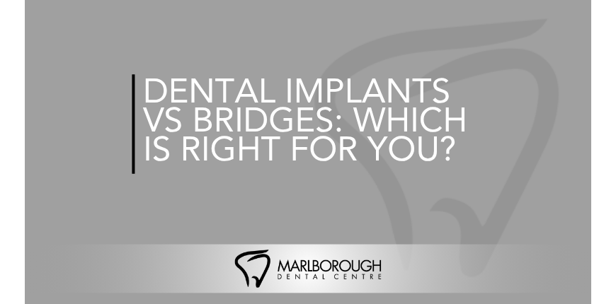 Compare dental implants and bridges to find the best tooth replacement option for your smile, health, and budget in Calgary.