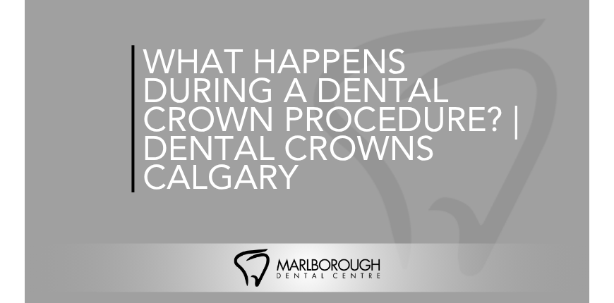 Learn what to expect during a dental crown procedure, from tooth preparation to final placement, with expert care at Marlborough Dental Centre.