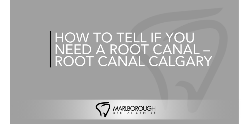 How to Tell If You Need a Root Canal – Root Canal Calgary