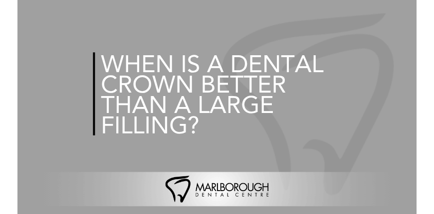 When Is a Dental Crown Better Than a Large Filling? When Is a Dental Crown Better Than a Large Filling?