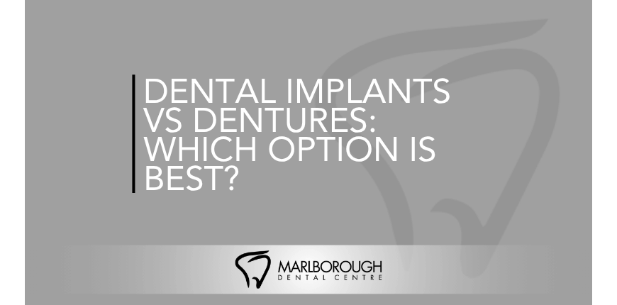 Dental Implants vs Dentures: Which Option Is Best? Dental Implants vs Dentures: Which Option Is Best?