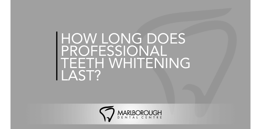 How Long Teeth Whitening Results Last | Calgary Teeth Whitening