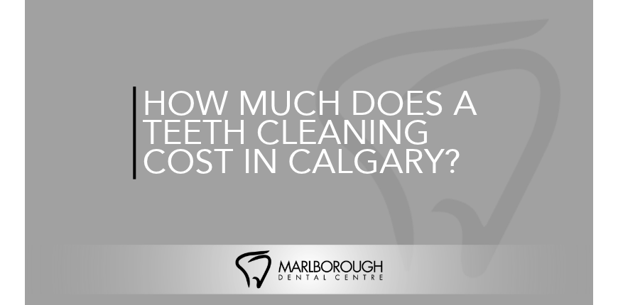 How Much Does a Teeth Cleaning Cost in Calgary? | Teeth Cleaning Cost Calgary How Much Does a Teeth Cleaning Cost in Calgary? | Teeth Cleaning Cost Calgary