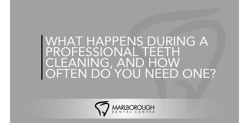 What Happens During a Professional Teeth Cleaning, and How Often Do You Need One? | Dental Cleaning Calgary What Happens During a Professional Teeth Cleaning, and How Often Do You Need One? | Dental Cleaning Calgary